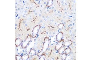 Immunohistochemistry (IHC) image for anti-Fc Fragment of IgG, High Affinity Ia, Receptor (CD64) (FCGR1A) (AA 200-292) antibody (ABIN3021695)