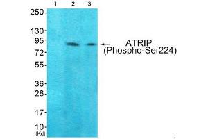 Western blot analysis of extracts from 293 cells (Lane 2) and Hela cells (Lane 3), using ATRIP (Phospho-Ser224) Antibody. (ATRIP Antikörper  (pSer224))