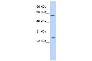 Western Blotting (WB) image for anti-Solute Carrier Family 18 (Vesicular Monoamine Transporter), Member 1 (SLC18A1) antibody (ABIN2458160) (SLC18A1 Antikörper)