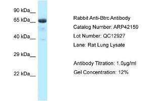 Host: Rabbit Target Name: BTRC Sample Tissue: Rat Lung Antibody Dilution: 1ug/ml