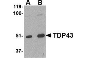 Western blot analysis of TDP43 in L1210 cell lysate with this product at (A) 0. (TARDBP Antikörper  (Center))