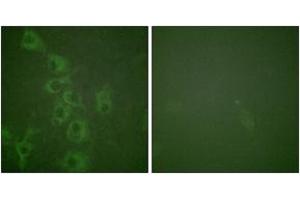 Immunofluorescence analysis of HuvEc cells, using Histamine H1 Receptor (Phospho-Ser398) Antibody. (HRH1 Antikörper  (pSer398))