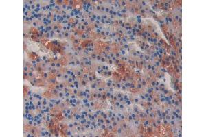 Used in DAB staining on fromalin fixed paraffin- embedded Kidney tissue (MTUS1 Antikörper  (AA 1020-1210))