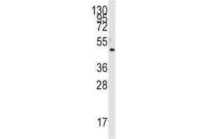 Western Blotting (WB) image for anti-Pyruvate Dehydrogenase Kinase, Isozyme 4 (PDK4) (AA 83-111) antibody (ABIN3032417)