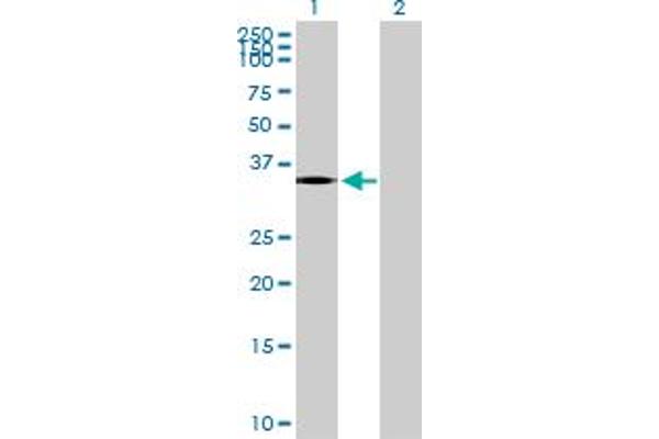 PTGDR Antikörper  (AA 1-359)