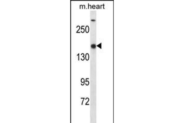 SETD1B Antikörper  (C-Term)