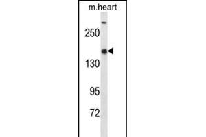 SET1B Antibody (C-term) (ABIN656346 and ABIN2845645) western blot analysis in mouse heart tissue lysates (35 μg/lane). (SETD1B Antikörper  (C-Term))