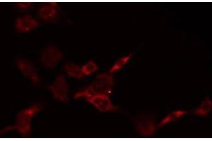 ABIN6278623 staining HepG2 by IF/ICC. (PSCA Antikörper)