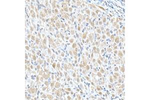 Immunohistochemistry of paraffin-embedded rat ovary using MTAP Rabbit pAb (ABIN6132365, ABIN6144119, ABIN6144120 and ABIN6214763) at dilution of 1:50 (40x lens). (MTAP Antikörper  (AA 1-283))