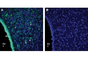 Expression of GPR18 in rat dorsomedial hypothalamus. (G Protein-Coupled Receptor 18 (GPR18) Peptid)
