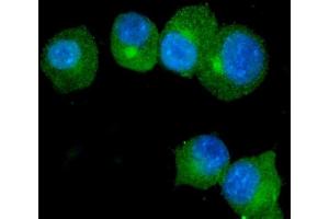 IF analysis of S100A9 using anti-S100A9 antibody (ABIN3042482). (S100A9 Antikörper  (AA 2-113))