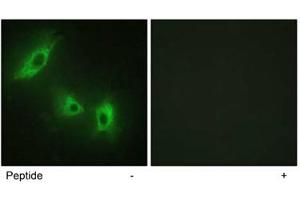 Immunofluorescence analysis of HeLa cells, using ACVR1B polyclonal antibody . (Activin A Receptor Type IB/ALK-4 Antikörper  (AA 73-122))