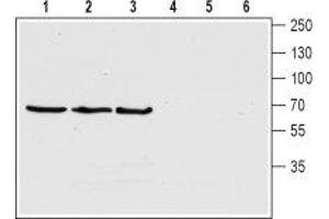 Western blot analysis of human SH-5YSY neuroblastoma cell lysate (lanes 1 and 4), rat (lanes 2 and 5) and mouse (lanes 3 and 6) brain lysates: - 1-3. (ChT Antikörper  (4th Extracellular Loop))