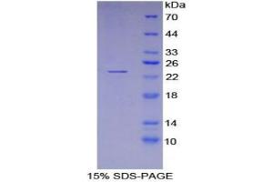 SDS-PAGE analysis of Mouse LEDGF Protein. (PSIP1 Protein)
