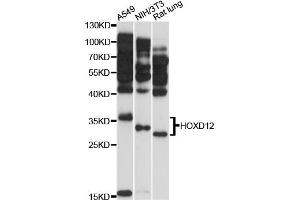 Western blot analysis of extracts of various cell lines, using HOXD12 antibody (ABIN6290492) at 1:3000 dilution.