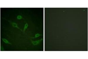 Immunofluorescence analysis of HeLa cells, using Keratin 18 (Phospho-Ser33) Antibody. (Cytokeratin 18 Antikörper  (pSer34))