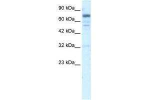 WB Suggested Anti-RIN3 Antibody Titration:  5. (RIN3 Antikörper  (N-Term))