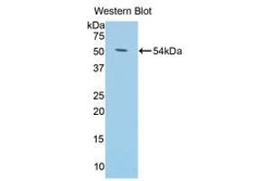 Western blot analysis of the recombinant protein. (Klotho Antikörper  (AA 59-508))