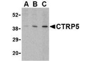 Western blot analysis of CTRP5 in caco-2 cell lysate with AP30255PU-N CTRP5 antibody at (A) 1, (B) 2, and (C) 4 μg/ml. (CTRP5 Antikörper  (Intermediate Domain))