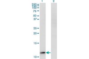 Western Blot analysis of RPP14 expression in transfected 293T cell line by RPP14 monoclonal antibody (M01A), clone 3H4. (RPP14 Antikörper  (AA 1-75))