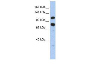 WB Suggested Anti-ZFR  Antibody Titration: 0. (ZFR Antikörper  (Middle Region))