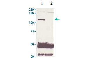 5 mg of the whole cell lysate derived from conditioned LNCaP were immunoprecipitated by 4 ug of AR (phospho S210) polyclonal antibody (Cat # PAB12654, lane 1) or pre adsorbed by immunization peptide (lane 2) followed by AR polyclonal antibody  at 1 : 500. (Androgen Receptor Antikörper  (pSer210))