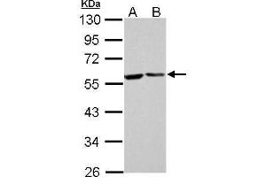 WB Image FKBP4 antibody detects FKBP4 protein by Western blot analysis. (FKBP4 Antikörper  (Center))