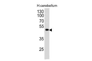 Western Blot of human Cerebellum lysate using PAX6 Monoclonal Antibody (PAX6/498). (PAX6 Antikörper  (N-Term))
