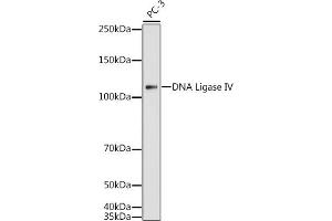 Western blot analysis of extracts of PC-3 cells, using DNA Ligase IV antibody (ABIN3022474, ABIN3022475, ABIN3022476 and ABIN6218843) at 1:1000 dilution.
