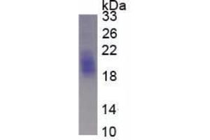 Image no. 2 for KIT Ligand (KITLG) (AA 25-191) (Active) protein (His tag) (ABIN6239749) (KIT Ligand Protein (KITLG) (AA 25-191) (His tag))