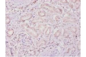 Immunohistochemistry of paraffin-embedded human kidney tissue using ABIN7159497 at dilution of 1:100 (TIMP4 Antikörper  (AA 31-224))