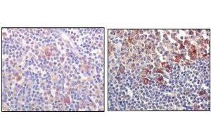 Immunohistochemical analysis of paraffin-embedded human lymph-node tissues (left) and human lymph follicle tissues (right), showing cytoplasmic and membrane localization using BTK mouse mAb with DAB staining. (BTK Antikörper)