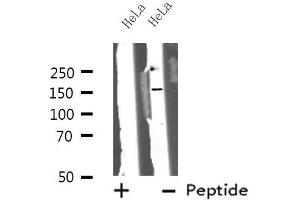 Western blot analysis of ZFYVE9 using HeLa whole cell lysates