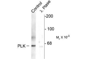 Image no. 1 for anti-Polo-Like Kinase 1 (PLK1) (pThr210) antibody (ABIN372703) (PLK1 Antikörper  (pThr210))