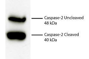 Total cell lysates from Jurkat cells were incubated with Rabbit Anti-Human DR5-UNLB secondary antibody and chemiluminescent detection. (Caspase 2 Antikörper)