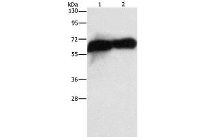 Western Blot analysis of HepG2 cell and Human placenta tissue using Placental Alkaline Phosphatase Polyclonal Antibody at dilution of 1:1450