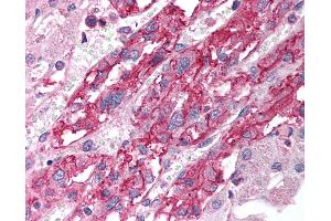 Anti-SLC18A1 / VMAT1 antibody IHC of human adrenal. (SLC18A1 Antikörper  (AA 103-152))