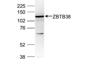 Western Blot of anti-ZBTB38 antibody Western Blot results of Rabbit anti-ZBTB38 antibody.