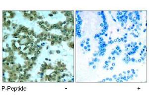 Image no. 1 for anti-Protein Kinase C, theta (PRKCQ) (pSer676) antibody (ABIN197071) (PKC theta Antikörper  (pSer676))