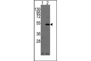 Western blot analysis of YBX1(arrow) using rabbit polyclonal YBX1 Antibody (YBX1 Antikörper  (C-Term))