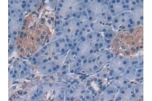 Immunohistochemistry (IHC) image for anti-2'-5'-Oligoadenylate Synthetase 2, 69/71kDa (OAS2) (AA 11-346) antibody (ABIN7436105)
