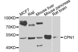 Western blot analysis of extracts of various cell lines, using CPN1 antibody (ABIN5974472) at 1/1000 dilution. (CPN1 Antikörper)
