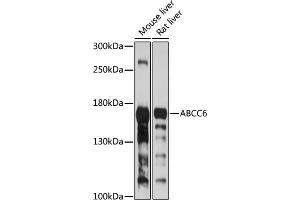 Western blot analysis of extracts of various cell lines, using  antibody (ABIN6134206, ABIN6136365, ABIN6136366 and ABIN6224126) at 1:1000 dilution. (ABCC6 Antikörper  (AA 830-940))