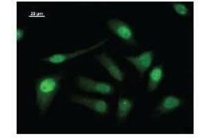 Immunostaining analysis in HeLa cells. (LSM10 Antikörper)