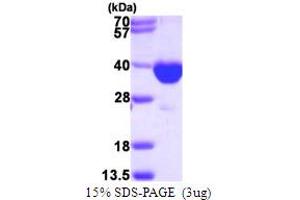 SDS-PAGE (SDS) image for Peroxisomal Trans-2-Enoyl-CoA Reductase (PECR) (AA 1-303) protein (His tag) (ABIN667579)