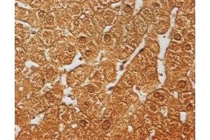 Immunohistochemistry (IHC) image for anti-Nuclear Receptor Subfamily 1, Group H, Member 4 (NR1H4) (AA 4-24), (Isoform 2) antibody (ABIN2703588)
