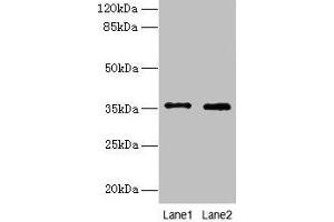 Western blot All lanes: FOXR2 antibody at 4 μg/mL Lane 1: SH-SY5Y whole cell lysate Lane 2: Hela whole cell lysate Secondary Goat polyclonal to rabbit IgG at 1/10000 dilution Predicted band size: 36 kDa Observed band size: 36 kDa (FOXR2 Antikörper  (AA 1-300))