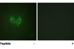 Immunofluorescence analysis of HUVEC cells, using MARK2 polyclonal antibody . (MARK2 Antikörper)