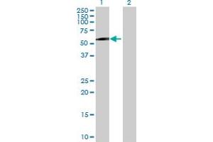 Western Blot analysis of MAGEC2 expression in transfected 293T cell line by MAGEC2 MaxPab polyclonal antibody. (MAGEC2 Antikörper  (AA 1-373))