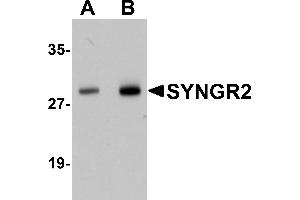 Western Blotting (WB) image for anti-Synaptogyrin 2 (SYNGR2) (N-Term) antibody (ABIN1031591) (SYNGR2 Antikörper  (N-Term))